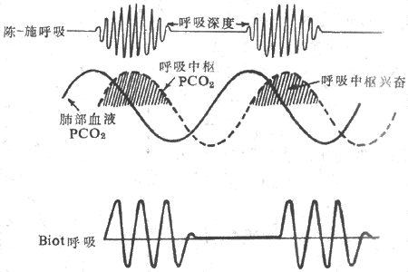 �쳣������ʽʾ��ͼ