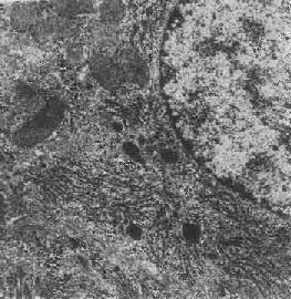 ������ø��