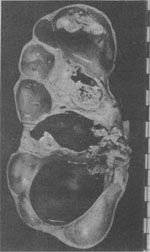 ��ѹ��ή��������ͷ״<a href=