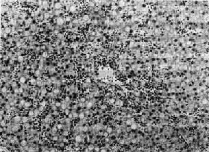 ���Ը���Ѫ