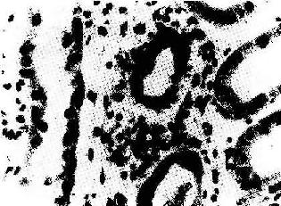 ����ֲ�����ųⷴӦ