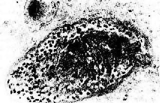 ����ֲ�����ųⷴӦ