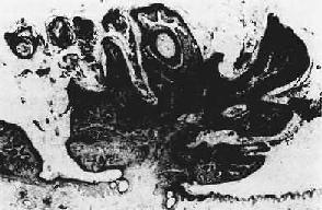 Ƥ����ͷ״<a href=