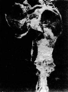 �߰���������