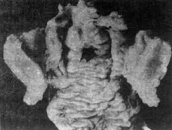 ����<a href=