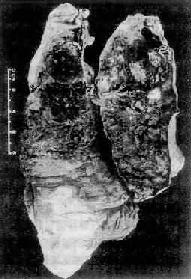 ͼ9-25 ���ν�˲�