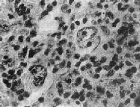 �νܽ�ʾ��Ӱϸ��