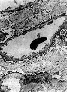 ��΢��������С������