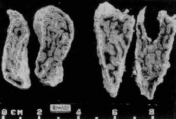 ������Ƥ���������������壩