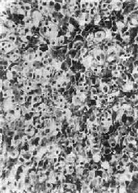 ������Ƥ��<a href=