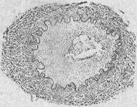 ���������岡��֢�����Զ�����ģʽͼ