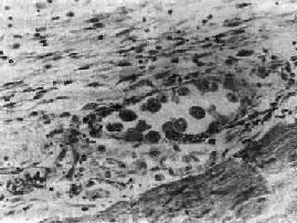 ���԰��װ�<a href=