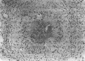 Ѫ���没֮���ڼ��Գ��ѽ��