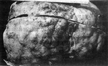 Ѫ���没�Ը�Ӳ��